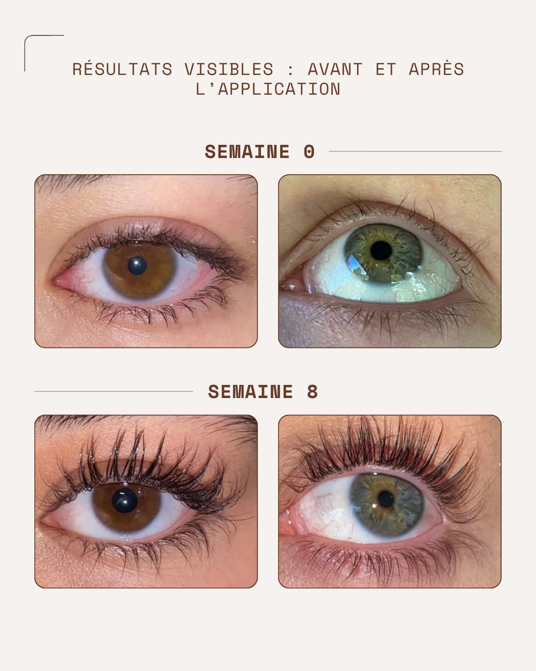 KosmaLash® | Sérum Croissance & Anti-chute